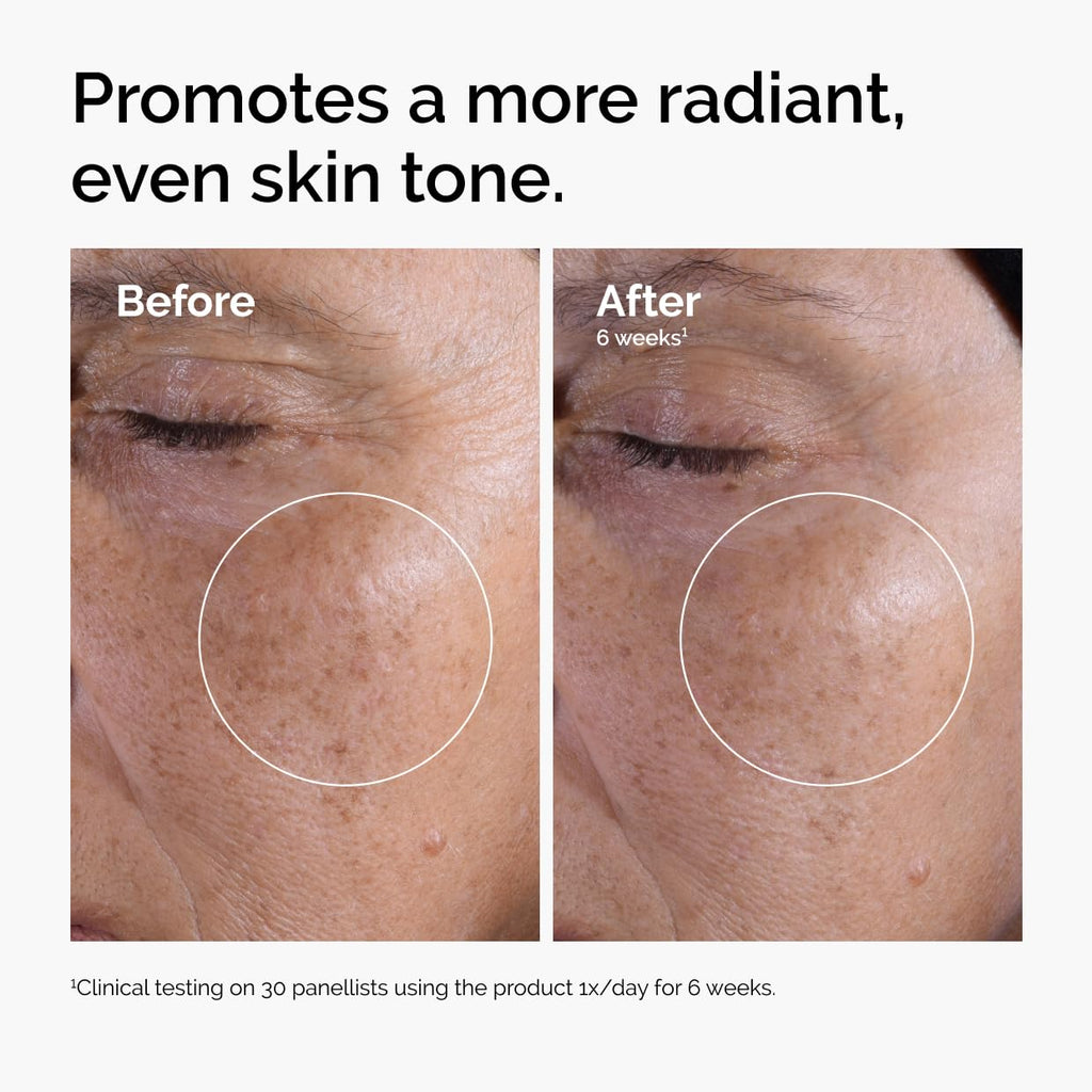 The Ordinary Glycolic Acid 7% Toner (8.1 Oz)